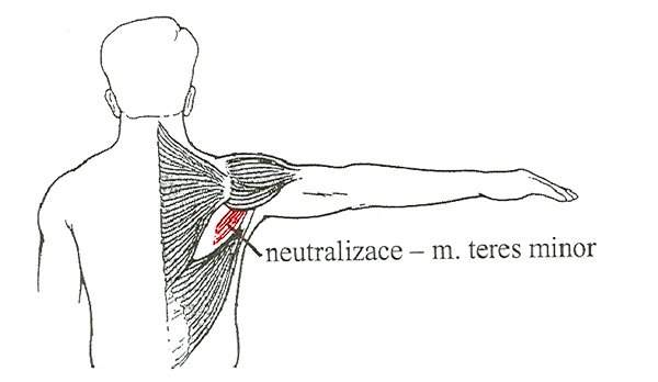 Neutralizace