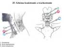 Schéma koniotomie a tracheotomie