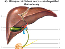 Mimojaterní žlučové cesty – extrahepatální žlučové cesty