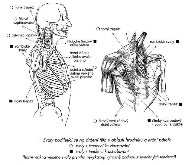 Svalová dysbalance v rámci dolního zkříženého syndromu