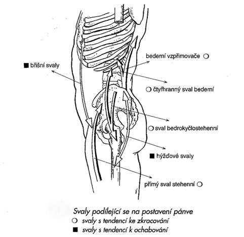 Svalová dysbalance v rámci dolního zkříženého syndromu