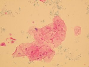 Squamous epithelial cells