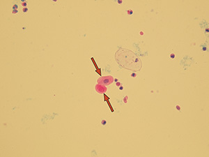 Transitional epithelial cells