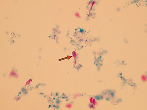 Caudate transitional epithelial cells