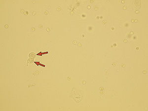 Transitional epithelial cells