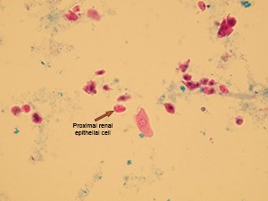 Renal tubular epithelia