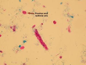 Renal tubular epithelia