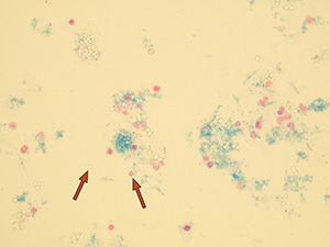 Erythrocytes and yeast together 