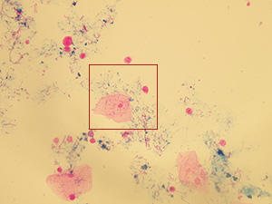 Bacteria inside squamous and transitional epithelia