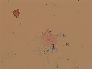 Squamous epithelial cell and oval fat body