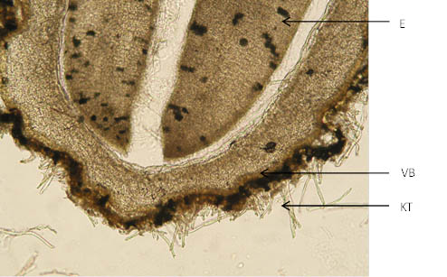 Strophanthi semen (×100)