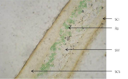 Lichen islandicus (×400)