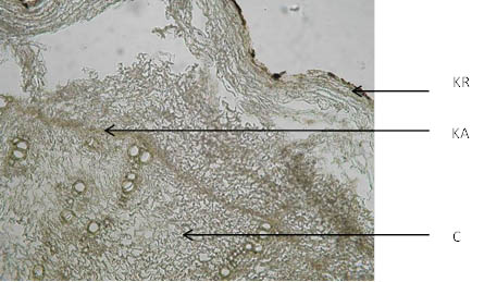 Gentianae radix (×100)