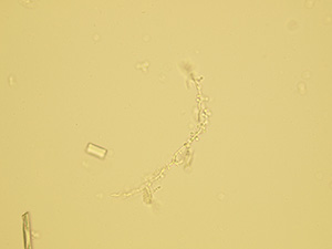 Pseudomycelia kvasinek