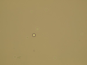 Fat droplets (artificial contamination)