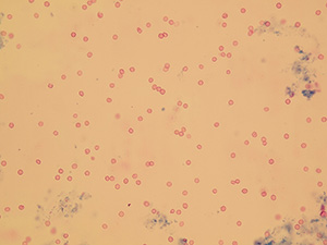 Erythrocytes