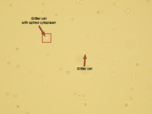 Granulocytes – glitter cells