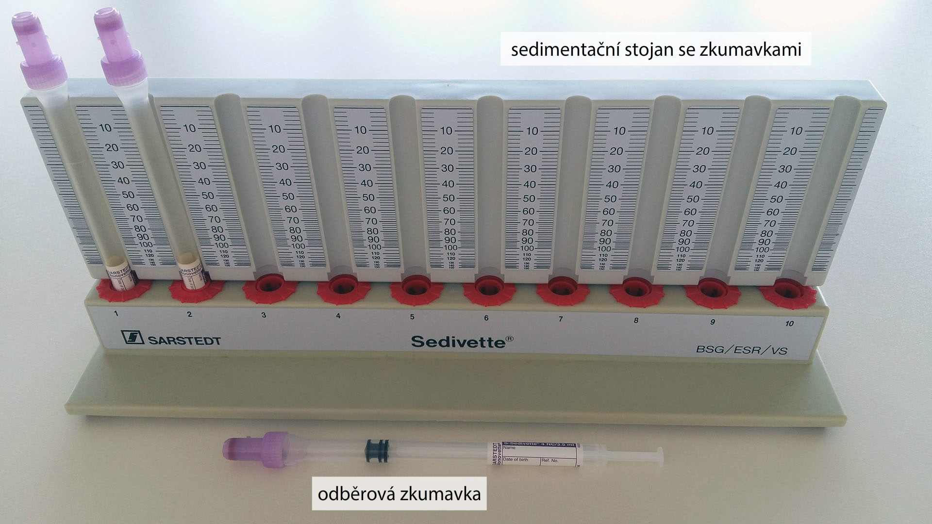 FW Sedimentace erytrocytů