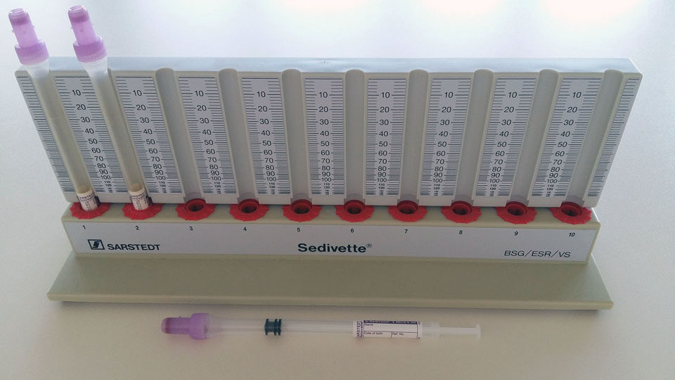 FW Sedimentace erytrocytů