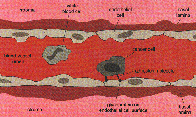 Adheze nádorových buněk na cévní stěny ve vzdálených tkáních