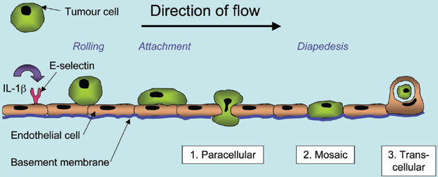 Prostup (diapedeze) nádorových buněk kolonu endotelem