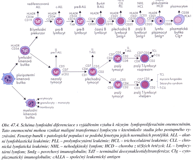 Schéma lymfoidní diferenciace s vyjádřením vztahu k různým lymfoproliferačním onemocněním