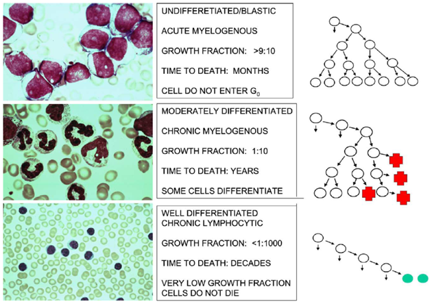 Růstová frakce, morfologie a klinický průběh tří typů leukémií