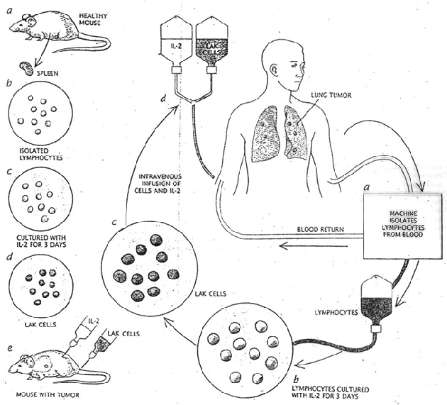 Využití LAK (lymphokine-activated killer) buněk v protinádorové terapii