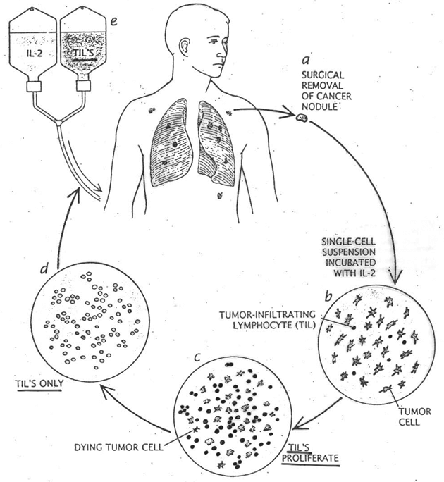 TIL‘S (tumor-infiltrating lymphocytes)