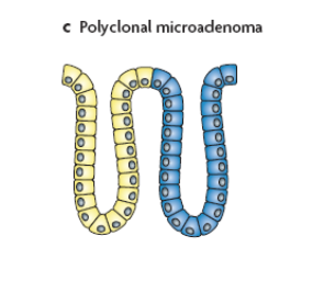 Polyclonal microadenoma