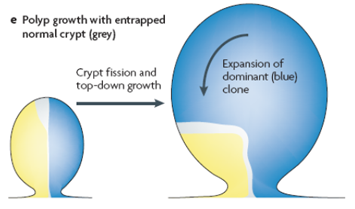 Polyp growth with entrapped normal crypt (grey)