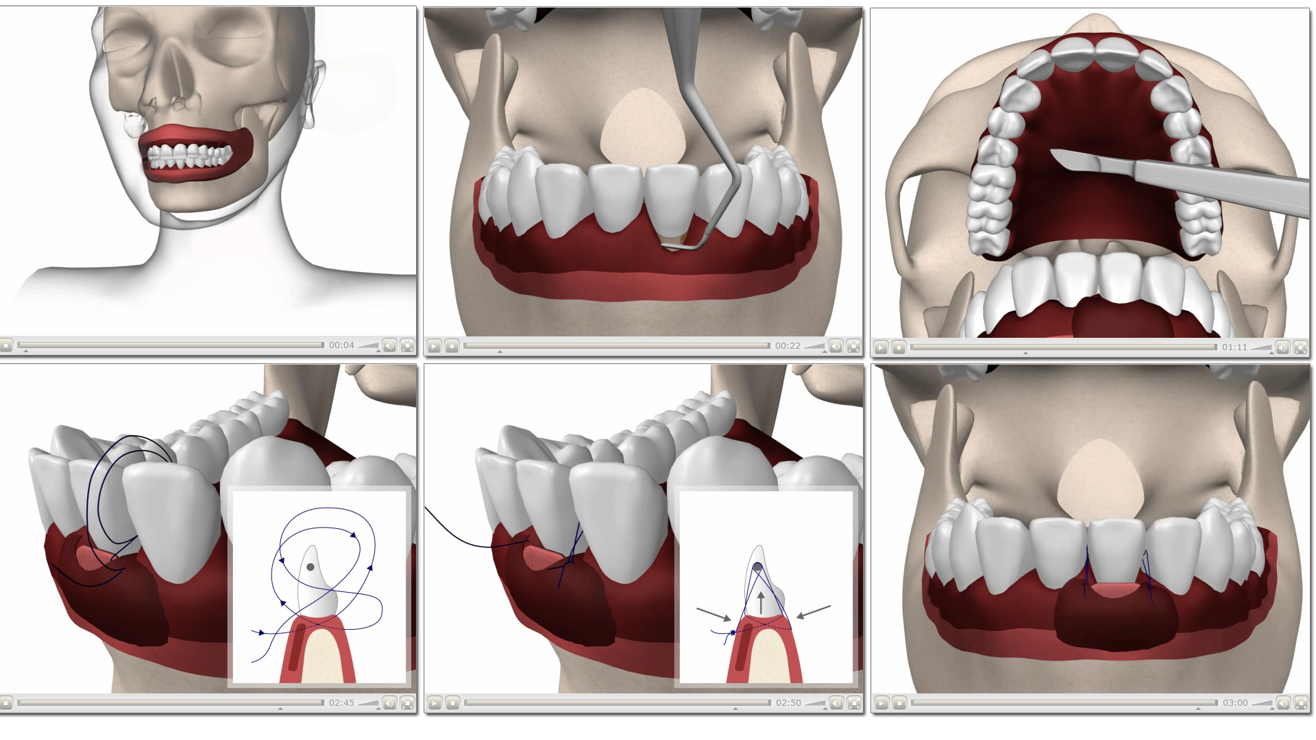 Dentální animace