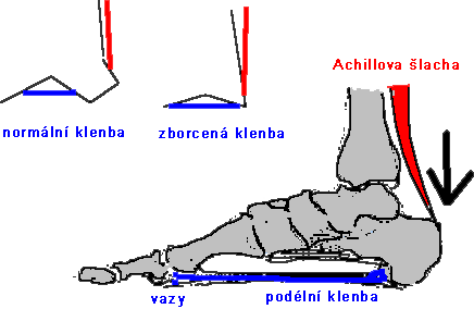 Obr. 46: místa zvýšeného napětí na noze