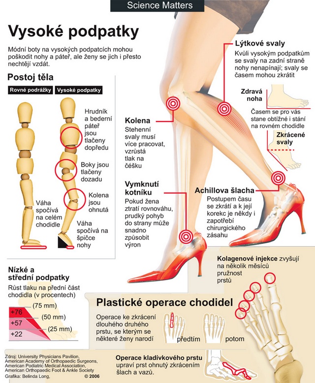 Obr. 33: vysoké podpadky ničí zdravé nohy (viz 2)