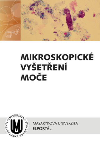 Mikroskopické vyšetření moče