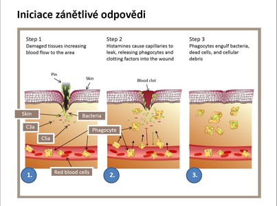 Iniciace zánětlivé odpovědi, prezentace pana prof. MUDr. Jiřího Litzmana, CSc. (LF)