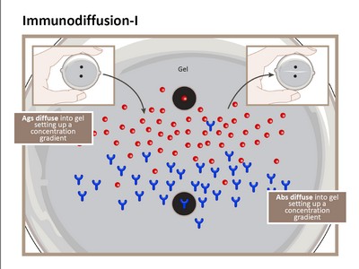 Immunodiffusion - I, prezentace pana prof. MUDr. Jiřího Litzmana, CSc. (LF)